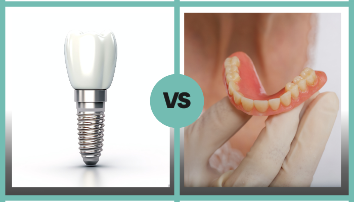 implantes Dentários e Prótese Dentária na Zona Leste - Odonto Gama