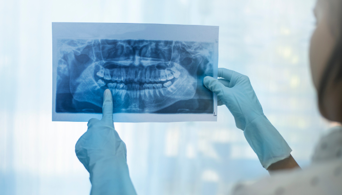 Atendimento odontológico 11 horas na Vila Matilde: solução sua a qualquer hora do dia!