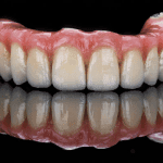 O que é prótese protocolo e por que pode mudar seu sorriso? Saiba tudo sobre essa solução fixa, confortável e duradoura. Agende agora na Odonto Gama!