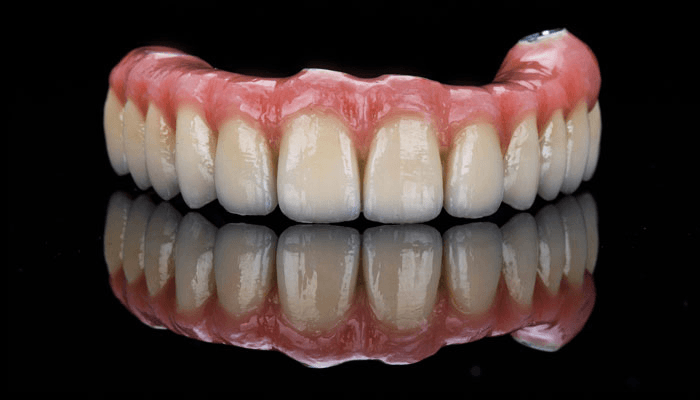 O que é prótese protocolo e por que pode mudar seu sorriso? Saiba tudo sobre essa solução fixa, confortável e duradoura. Agende agora na Odonto Gama!