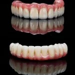 Prótese Protocolo Superior e Inferior: Diferenças no Tratamento