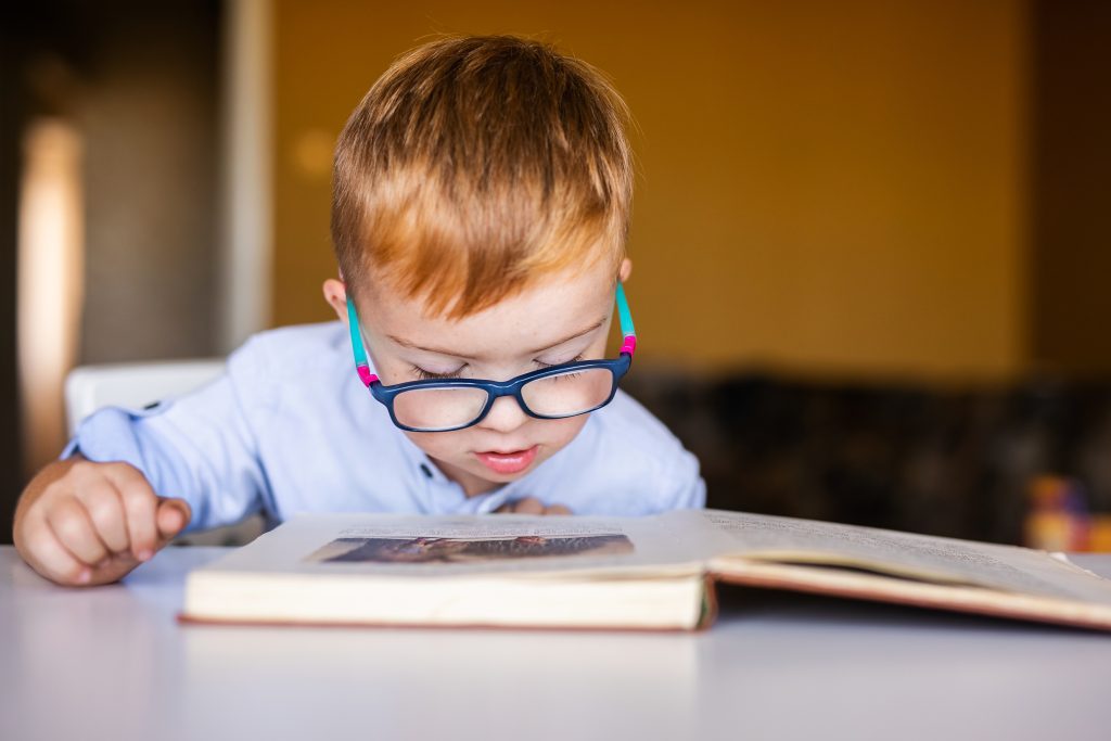 sindrome de down - paciente especial