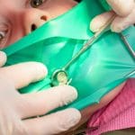 Sofrimento silencioso: entenda os Sintomas de dente com canal inflamado
