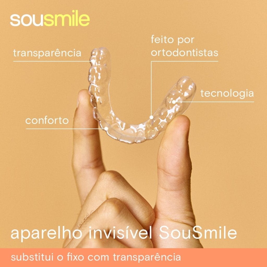 Alinhador Invisível Sousmile: O que é, Como Funciona e Para Quem é Indicado
