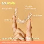 Alinhador Invisível Sousmile: O que é, Como Funciona e Para Quem é Indicado