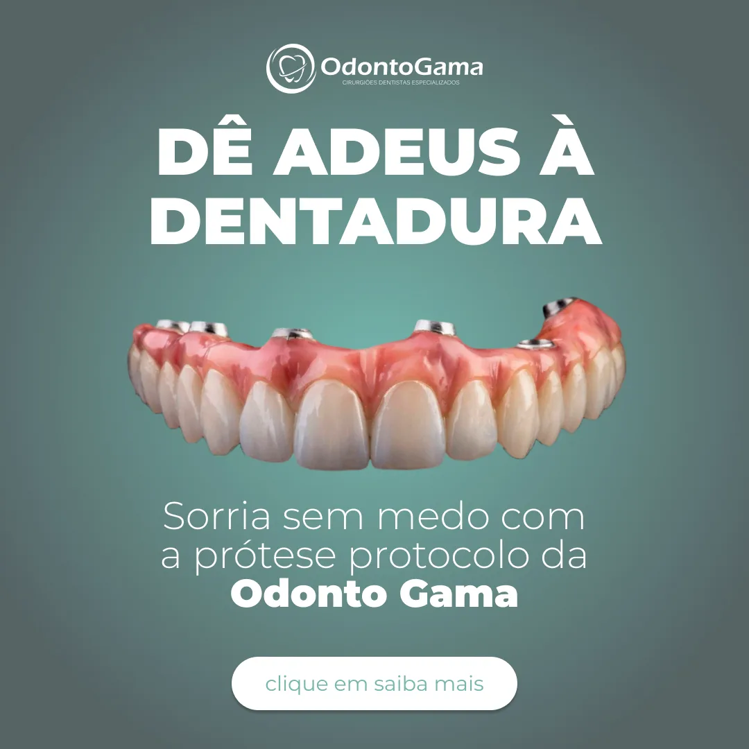 Prótese Protocolo: Guia Completo sobre a Solução que Devolve seu Sorriso