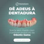 Quanto Custa uma Prótese Protocolo em 2025? Valores Atualizados