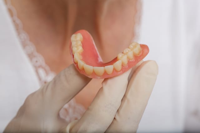 Diferença entre prótese comum e overdenture barra clipe: qual escolher?